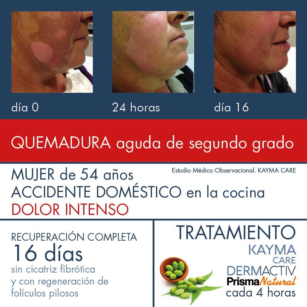 prisma natural KAYMA CARE DERMACTIV COMPRAR AHORA
